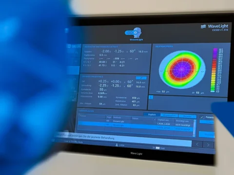 Femto-Lasik Operationsmonitor