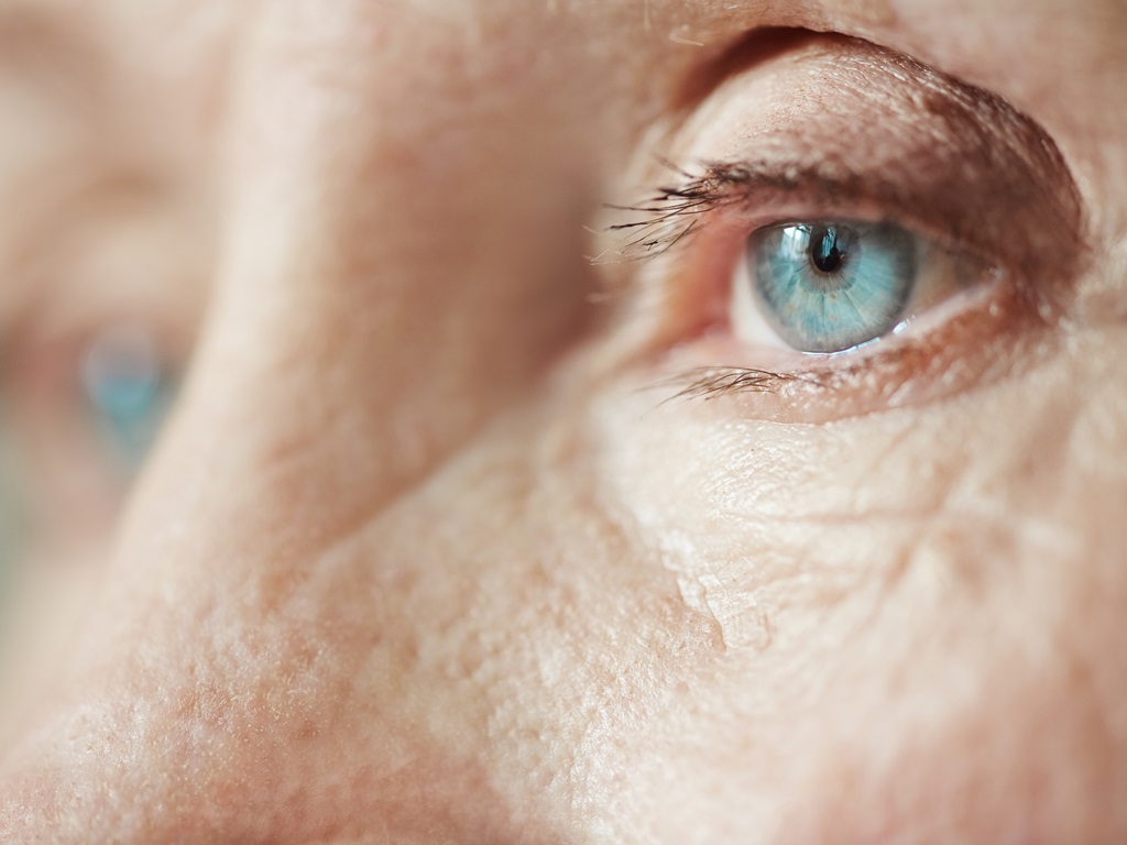 Person mit Katarakt